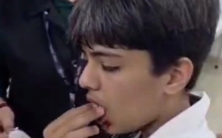 कानून भूली पुलिस, डीपीएस छात्र हमले में एफआईआर बनी मुसीबत, दरोगा समेत  तीन सस्पेंड