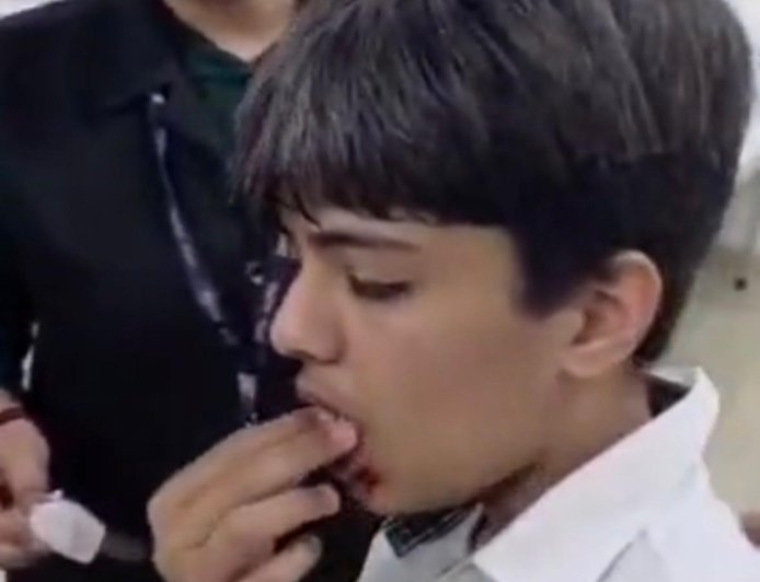 कानून भूली पुलिस, डीपीएस छात्र हमले में एफआईआर बनी मुसीबत, दरोगा समेत  तीन सस्पेंड