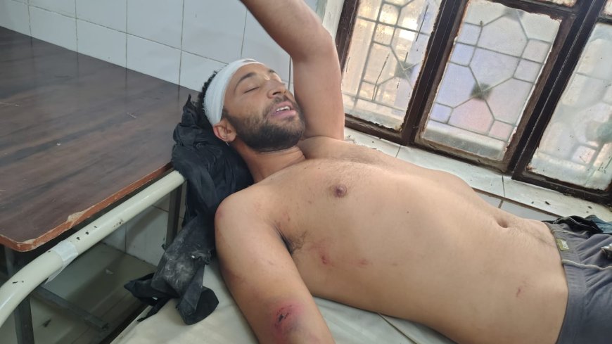 इश्क की सजा: प्रेमिका से मिलने के लिए फतेहाबाद क्षेत्र में पहुंचे बागपत के युवक को युवती के ससुरालीजनों ने पेड़ से बांधकर पीटा, अस्पताल में भर्ती कराना पड़ा
