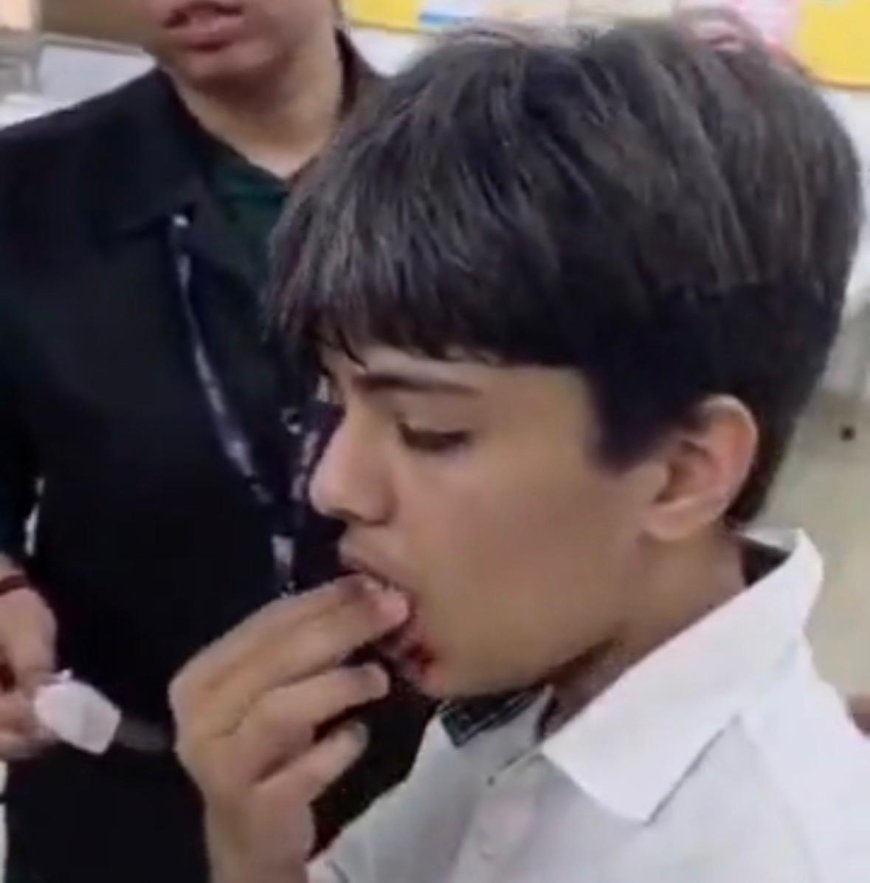 कानून भूली पुलिस, डीपीएस छात्र हमले में एफआईआर बनी मुसीबत, दरोगा समेत  तीन सस्पेंड