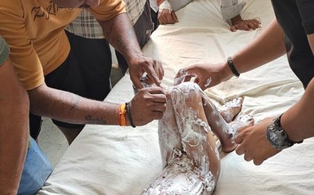धधकती भट्टी के सामने मासूम की चीखें: आगरा के बाह में हलवाई की दुकान पर स्कूटी के एक्सीलेटर ने बरपाया कहर, खौलते तेल से झुलसा साढ़े तीन साल का मयंक