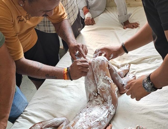 धधकती भट्टी के सामने मासूम की चीखें: आगरा के बाह में हलवाई की दुकान पर स्कूटी के एक्सीलेटर ने बरपाया कहर, खौलते तेल से झुलसा साढ़े तीन साल का मयंक