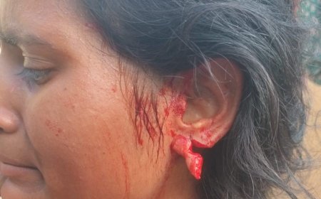 खंदौली में शिकायत का खौफनाक अंजाम: युवती पर घर में घुसकर हमला, दराती से काटा कान, हाथ पर भी दांतों से किया वार