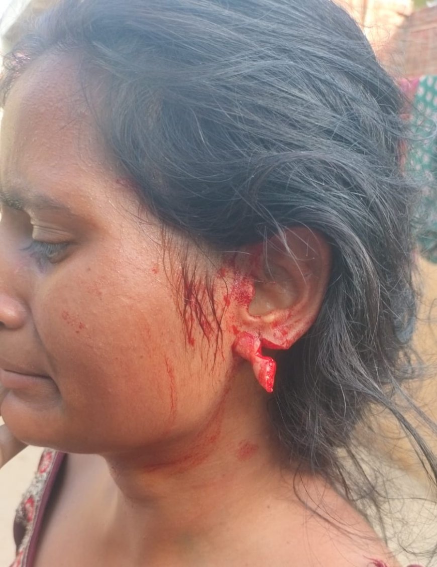 खंदौली में शिकायत का खौफनाक अंजाम: युवती पर घर में घुसकर हमला, दराती से काटा कान, हाथ पर भी दांतों से किया वार