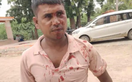 छोटे भाई का विवाद सुलझाने पहुंचे बड़े भाई पर हमला, सिर में डंडा लगने से गंभीर घायल