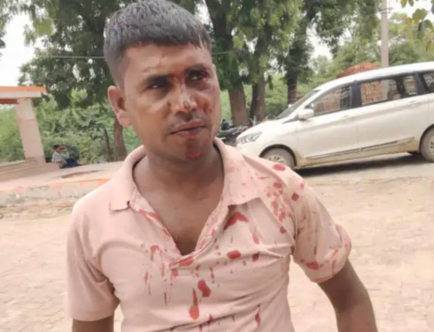 छोटे भाई का विवाद सुलझाने पहुंचे बड़े भाई पर हमला, सिर में डंडा लगने से गंभीर घायल