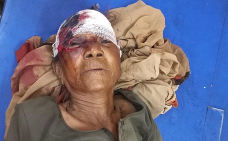 आगरा के पिनाहट कस्बे में कुत्ते के हमले में बुजुर्ग महिला गंभीर घायल, सिर और शरीर पर किए गहरे घाव