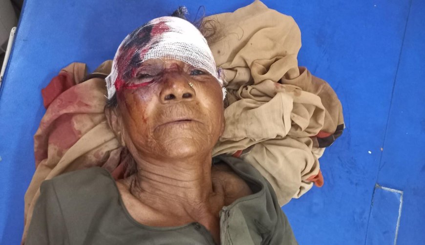 आगरा के पिनाहट कस्बे में कुत्ते के हमले में बुजुर्ग महिला गंभीर घायल, सिर और शरीर पर किए गहरे घाव
