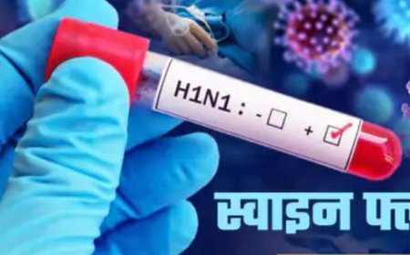 स्वाइन फ्लू ने ली वरिष्ठ चिकित्सक की जान,आगरा के निजी अस्पताल में एटा के डॉक्टर की मौत