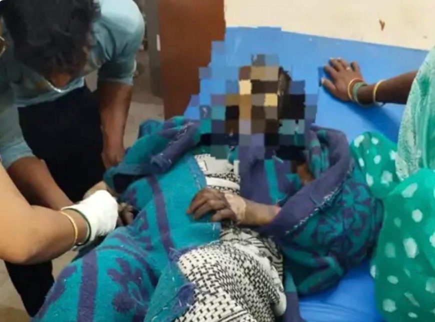 पिनाहट में 24 वर्षीय महिला ने खुद को आग लगाई, 90 फीसदी झुलसी, आगरा रेफर