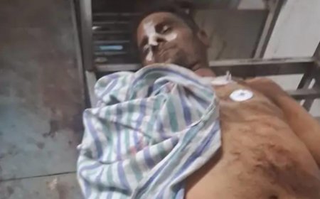 आगरा में ढाबे पर खूनी वारदात, सीने में गोली मारकर युवक की हत्या,आरोपी की तलाश जारी